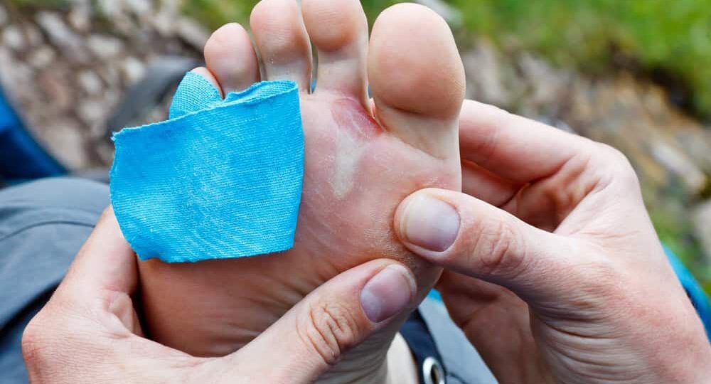 How to Prevent Blisters While Hiking Kilimanjaro