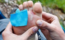 How to Prevent Blisters While Hiking Kilimanjaro